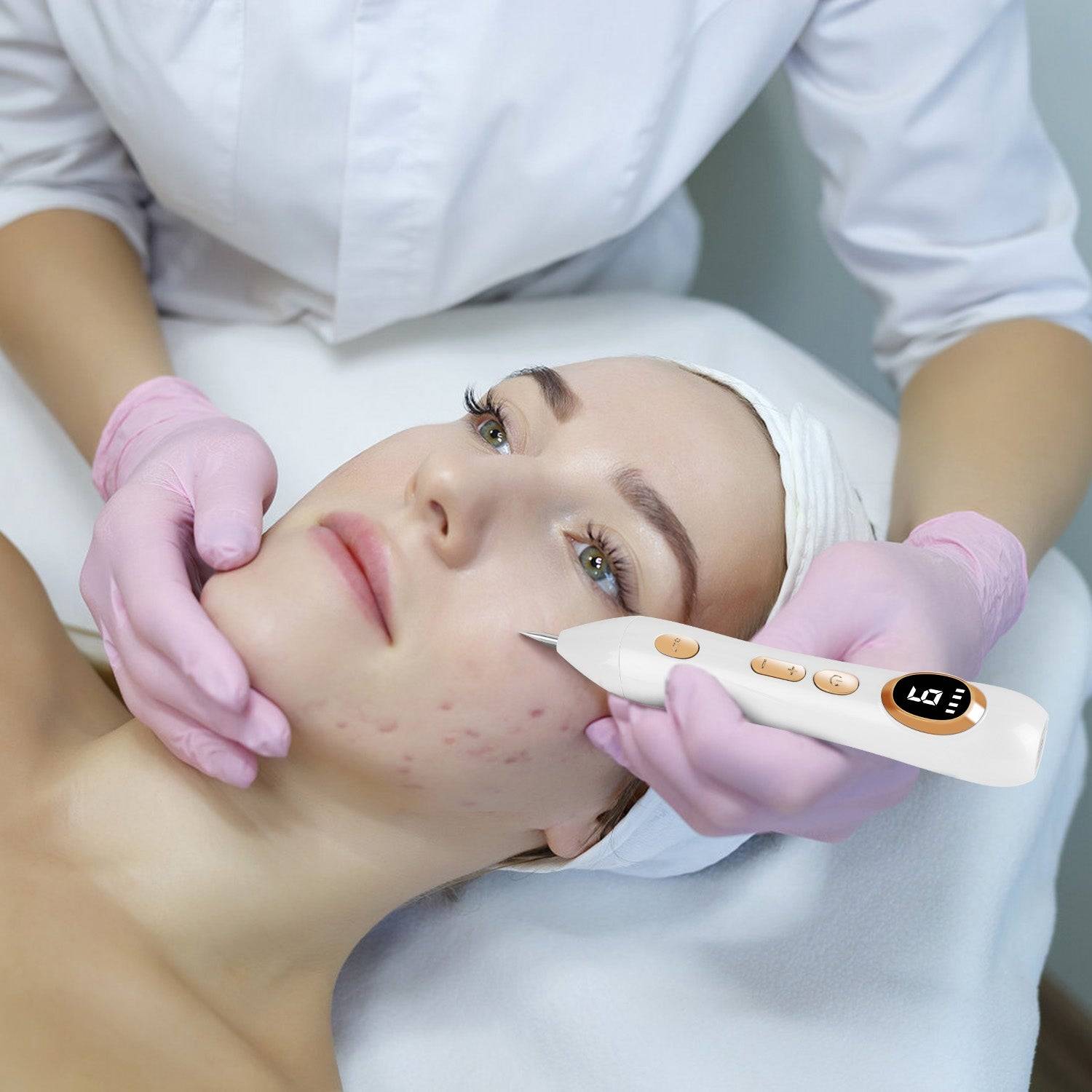 Skin Tag Remover Pen with LED Light and 9 Intensity Levels