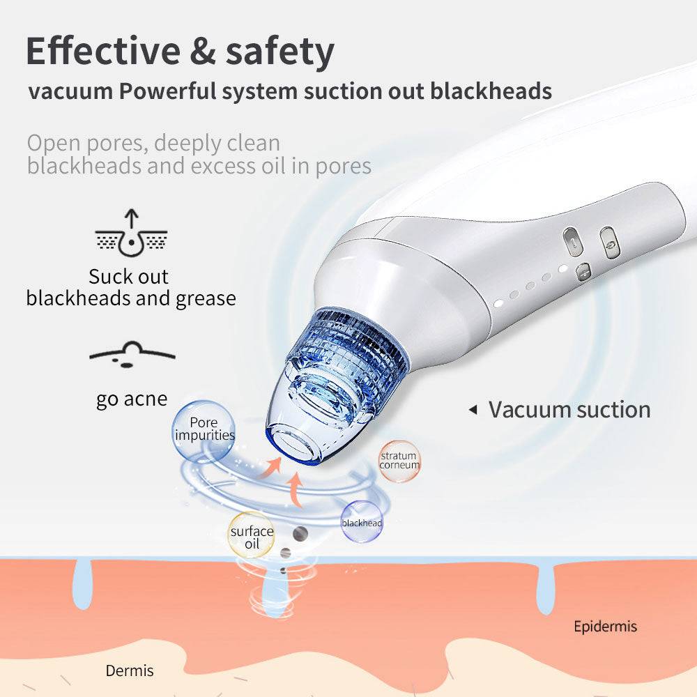 Blackhead Remover Electric Vacuum with 4 Levels