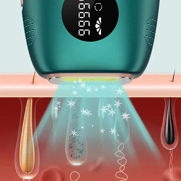 Laser Hair Removal Device with IPL and Adjustable Levels