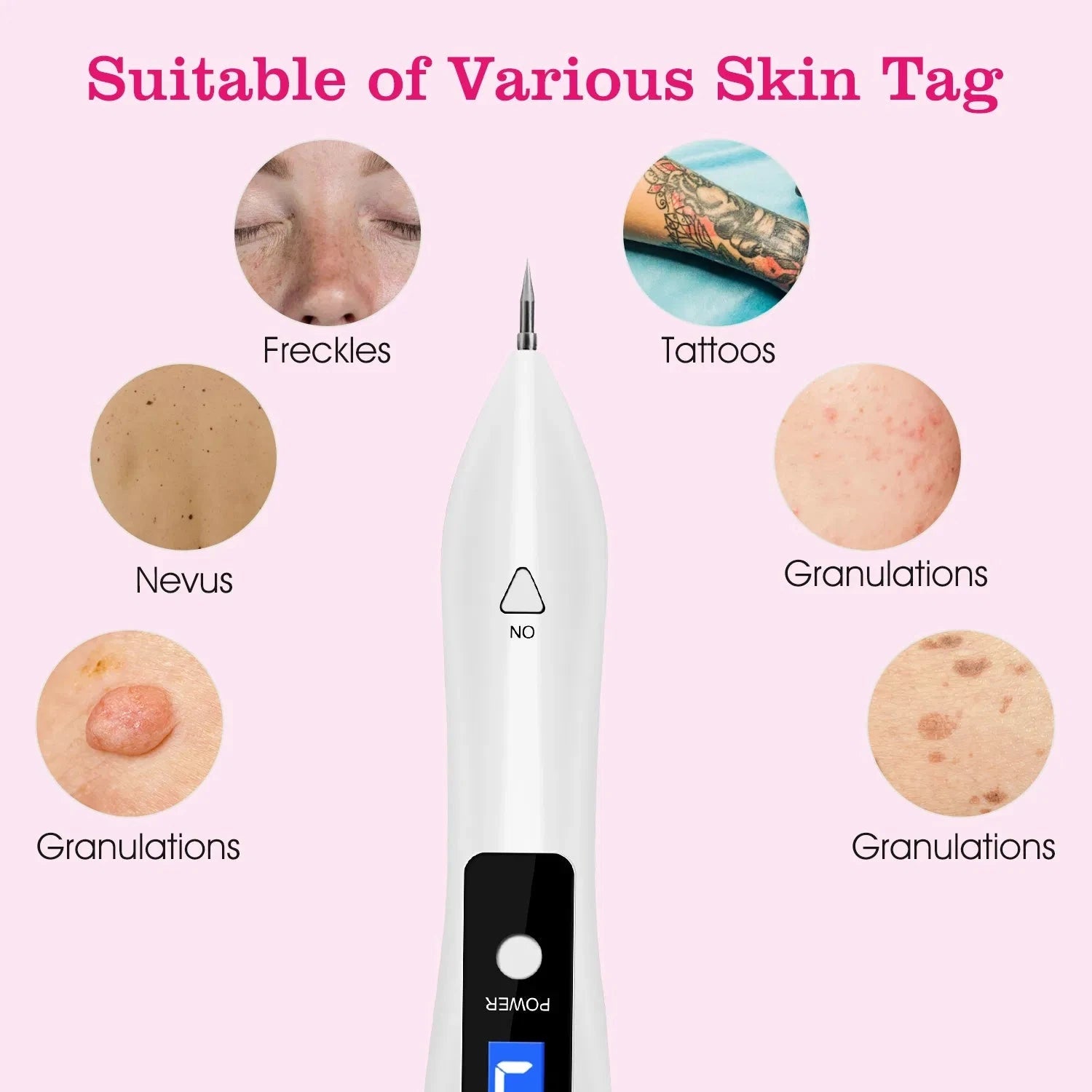 Skin Tag Remover Portable Electronic Repair Kit