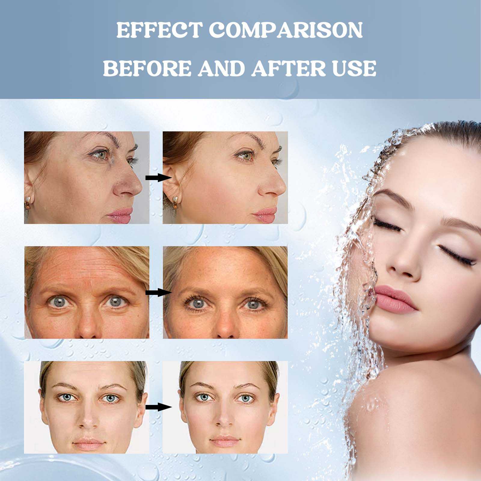 Bio Collagen Face Mask Hydrating Skin Care 4 Pack