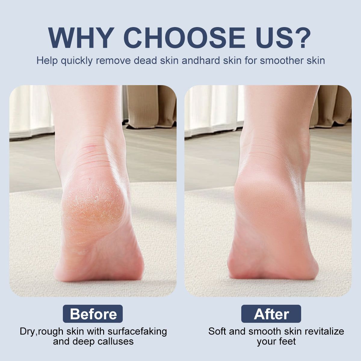 Electric Callus Remover with Rechargeable Digital Display