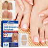 Toenail fungus treatment stickers - PMMNAPOLES