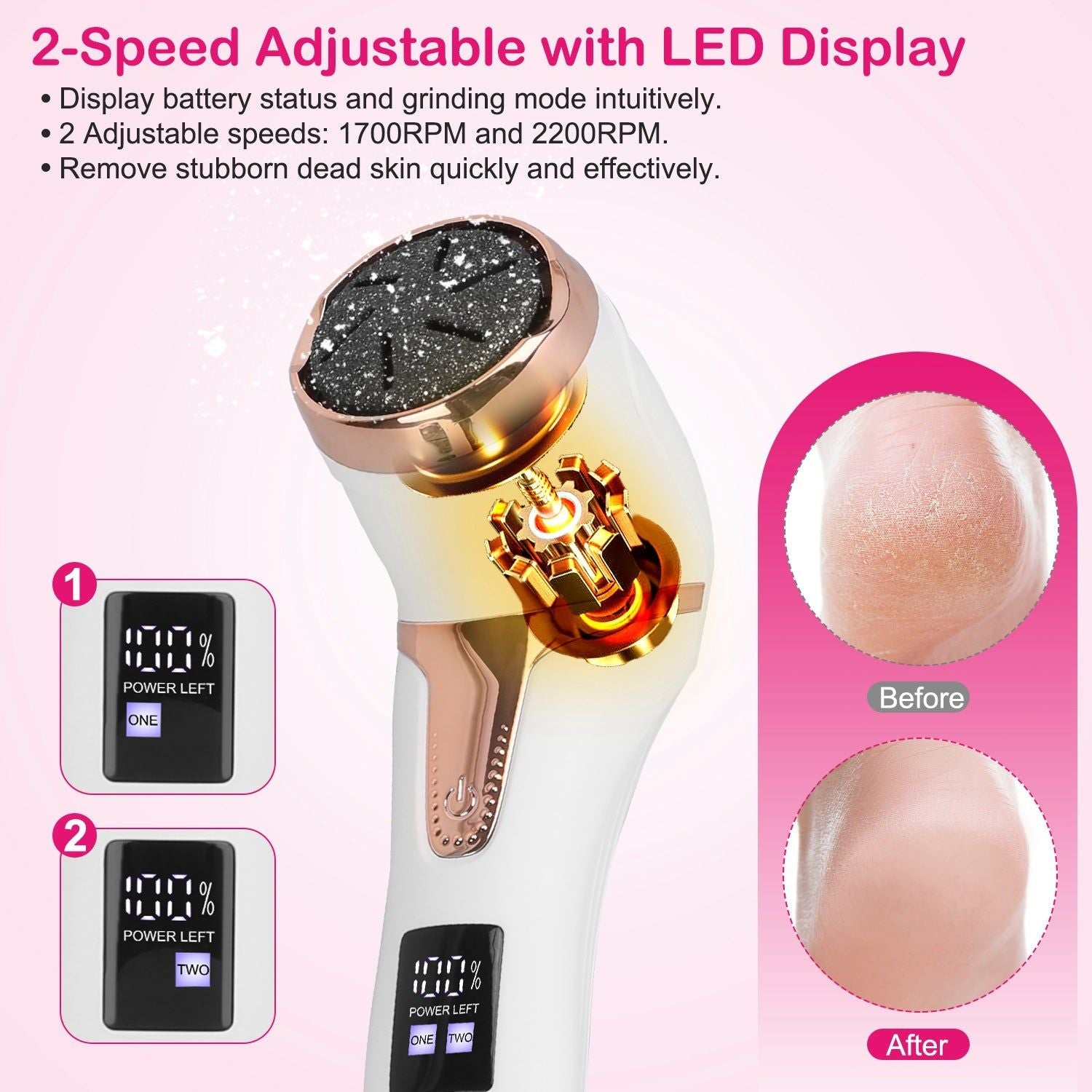 Callus Remover Electric Dual Speed Vacuum Pedicure Kit